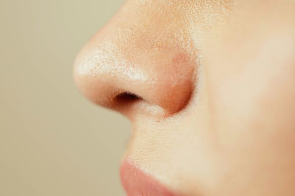 Facial oily or acne-prone skin